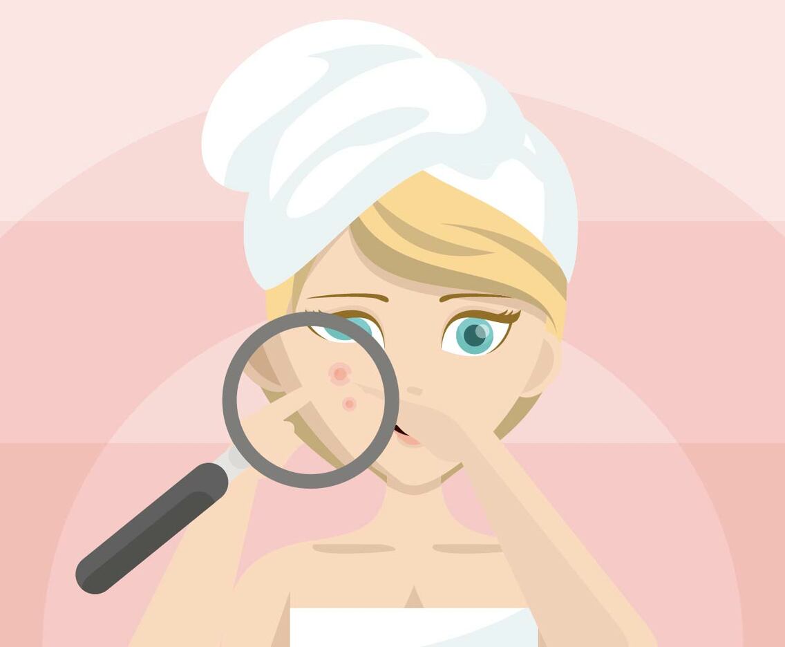 Pimple Illustration