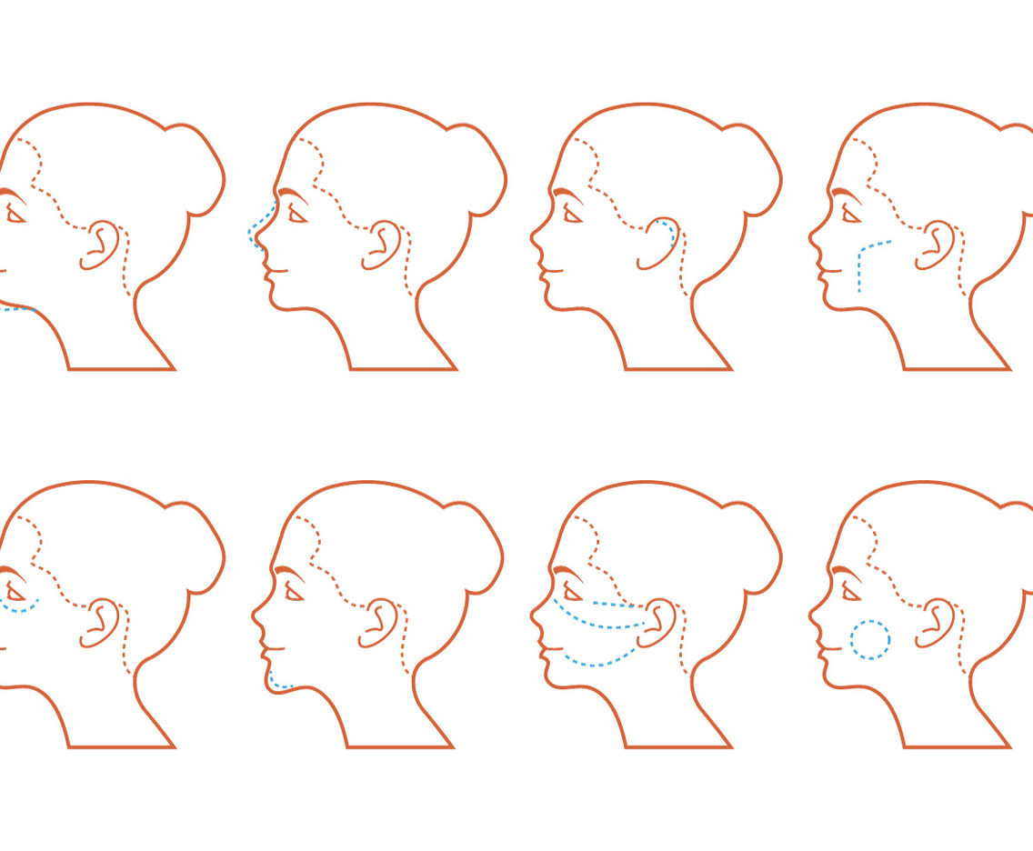 Face Surgery