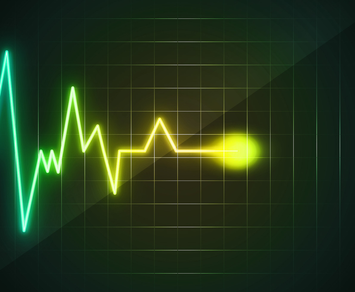 Heart Monitor Wave Free