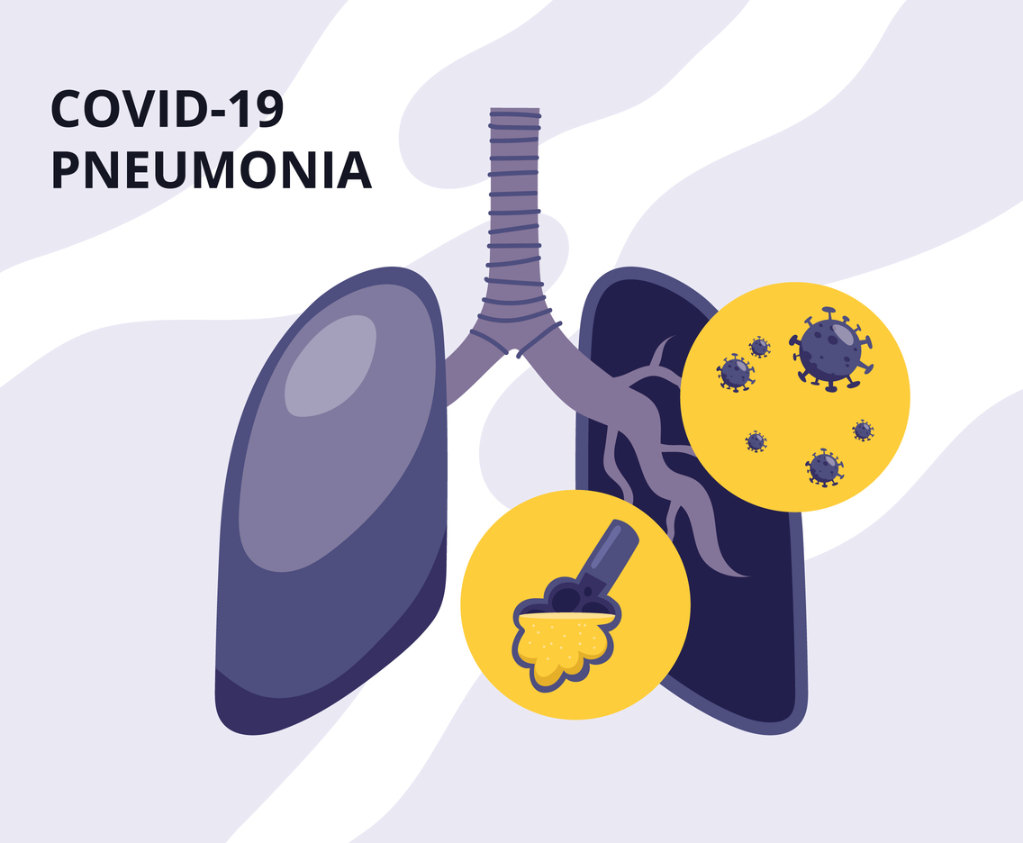 Covid19 Pneumonia Lungs
