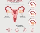 Ovarian Cancer Infographic